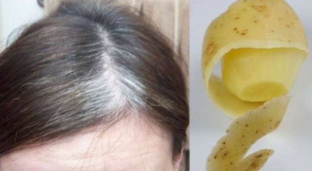 potato-peel-for-grey-hair-580x305